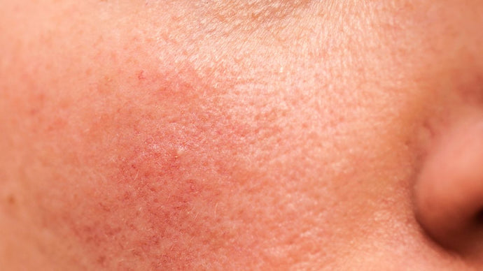 Sensitive Skin’s Softest Secret: Why Silk Could Be the Remedy You’ve Been Searching For