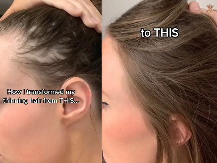 TikTok Sensation Reveals the Secrets Behind Her Stunning Hair Transformation